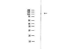 Western blot analysis of lysates from COLO205 cells(heat-shock,45 min treatment), using IFIH1 Antibody at 1/1000 dilution.