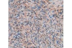 Figure. (MMP11 antibody  (AA 302-458))