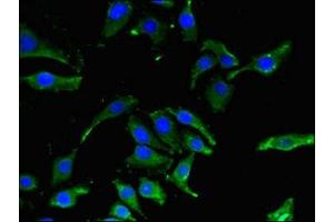 Immunofluorescent analysis of A549 cells using ABIN7146741 at dilution of 1:100 and Alexa Fluor 488-congugated AffiniPure Goat Anti-Rabbit IgG(H+L) (CBR1 antibody  (AA 176-268))
