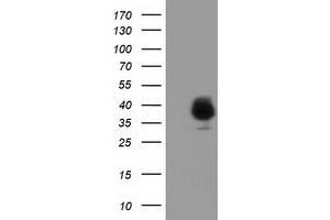 HEK293T cells were transfected with the pCMV6-ENTRY control (Left lane) or pCMV6-ENTRY FAM84B (Right lane) cDNA for 48 hrs and lysed. (FAM84B antibody)