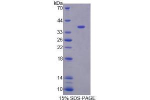 SDS-PAGE analysis of Human XRN1 Protein.