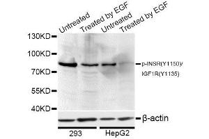 Western blot analysis of extracts of 293 and HepG2 cells, using Phospho-INSR-Y1150/IGF1R-Y1135 antibody (ABIN5969901) at 1/1000 dilution. (Insulin Receptor antibody  (pTyr1135, pTyr1150))