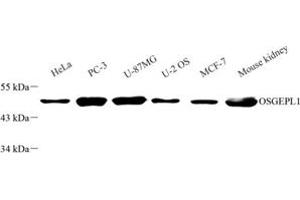 Western blot analysis of OSGEPL1 (ABIN7074934) at dilution of 1: 2000