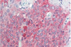 ABIN571264 (5µg/ml) staining of paraffin embedded Human Tonsil. (TMEM205 antibody  (AA 137-146))