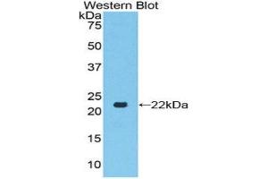 Western Blotting (WB) image for anti-Toll-Like Receptor 7 (TLR7) (AA 887-1036) antibody (ABIN1860776) (TLR7 antibody  (AA 887-1036))