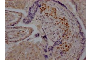 IHC image of ABIN7127812 diluted at 1:100 and staining in paraffin-embedded human placenta tissue performed on a Leica BondTM system. (Recombinant SKP2 antibody)