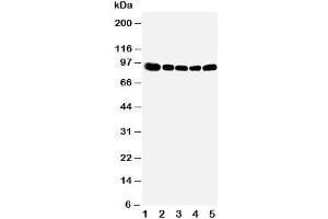 Western blot testing of OSBP antibody and Lane 1:  rat kidney;  2: (r) spleen;  3: (r) lung;  4: human HeLa;  5: (h) A549 cell lysate