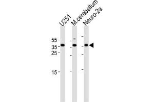 Western Blotting (WB) image for anti-Empty Spiracles Homeobox 1 (EMX1) antibody (ABIN3003987)