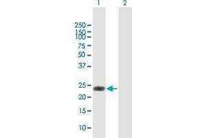 Western Blot analysis of VEGFB expression in transfected 293T cell line by VEGFB MaxPab polyclonal antibody. (VEGFB antibody  (AA 1-207))