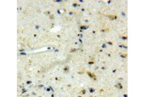 Immunohistochemistry (IHC) image for anti-Membrane Protein, Palmitoylated 5 (MAGUK P55 Subfamily Member 5) (MPP5) (AA 455-675) antibody (ABIN2119305)