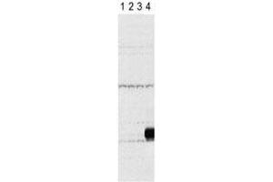 Western blot testing of Aurora-C antibody and lysate of 293 cells expressing Flag tag (lane 1), Flag-tagged Aurora-A (2), -B (3), -C (4). (Aurora Kinase C antibody  (AA 3-38))