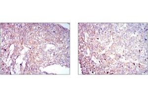Immunohistochemistry (IHC) image for anti-Coactosin-Like Protein antibody (ABIN1106731) (COTL1 antibody)
