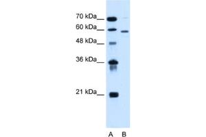 Western Blotting (WB) image for anti-Asparagine-Linked Glycosylation 11, alpha-1,2-Mannosyltransferase Homolog (Yeast) (ALG11) antibody (ABIN2462823)