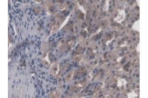 Immunohistochemistry (IHC) image for anti-Core-Binding Factor, beta Subunit (CBFB) (AA 1-187) antibody (ABIN7444325)