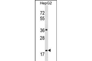 M1M Antibody (Center) (ABIN1537819 and ABIN2848601) western blot analysis in HepG2 cell line lysates (35 μg/lane). (PPM1M antibody  (AA 130-158))