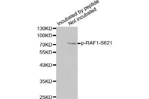 Western Blotting (WB) image for anti-V-Raf-1 Murine Leukemia Viral Oncogene Homolog 1 (RAF1) (pSer621) antibody (ABIN6225462) (RAF1 antibody  (pSer621))