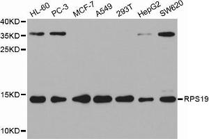 Western blot analysis of extracts of various cell lines, using RPS19 antibody. (RPS19 antibody  (AA 1-145))