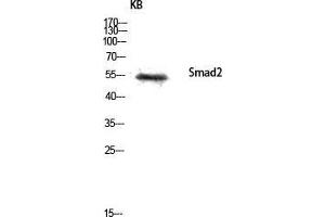 Western Blotting (WB) image for anti-SMAD, Mothers Against DPP Homolog 2 (SMAD2) (Ser80) antibody (ABIN3186987)