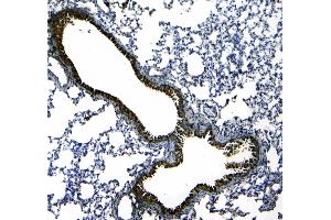 IHC analysis of Uteroglobin using anti-Uteroglobin antibody . (SCGB1A1 antibody  (AA 22-96))