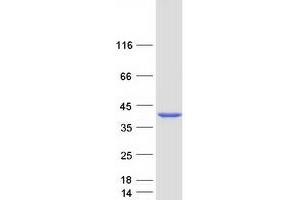 Validation with Western Blot (Ribokinase Protein (RBKS) (Myc-DYKDDDDK Tag))