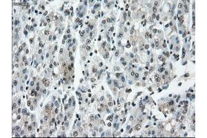 Image no. 19 for anti-P450 (Cytochrome) Oxidoreductase (POR) antibody (ABIN1497746) (POR antibody)