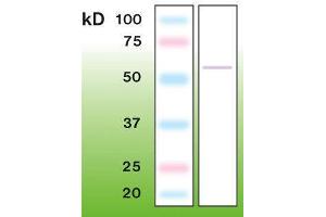 Western Blotting (WB) image for anti-Tumor Protein P53 (TP53) (C-Term) antibody (ABIN870298) (p53 antibody  (C-Term))