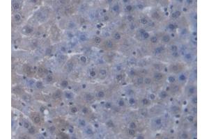 DAB staining on IHC-P; Samples: Rat Liver Tissue (TAP2 antibody  (AA 467-703))