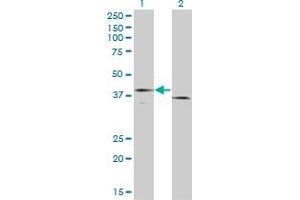 Western Blot analysis of F3 expression in transfected 293T cell line by F3 monoclonal antibody (M01A), clone 4G4.
