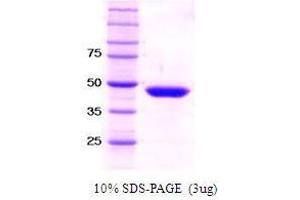 Figure annotation denotes ug of protein loaded and % gel used. (SET7/9 Protein)
