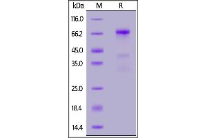 Biotinylated Human Glypican 3, His,Avitag on  under reducing (R) condition. (Glypican 3 Protein (GPC3) (AA 25-559) (His tag,AVI tag,Biotin))