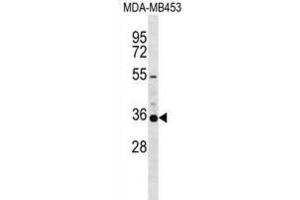 Western Blotting (WB) image for anti-Potassium Voltage-Gated Channel, Shaker-Related Subfamily, Member 5 (KCNA5) antibody (ABIN2999168) (KCNA5 antibody)