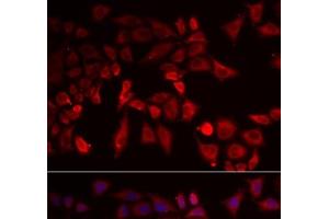 Immunofluorescence analysis of MCF-7 cells using PYGL Polyclonal Antibody (PYGL antibody)