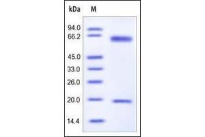 Mouse PCSK9, His Tag on SDS-PAGE under reducing (R) condition. (PCSK9 Protein (AA 35-694) (His tag))