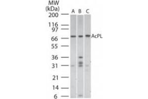 Image no. 1 for anti-Interleukin 18 Receptor Accessory Protein (IL18RAP) (AA 50-100) antibody (ABIN199977) (IL18RAP antibody  (AA 50-100))