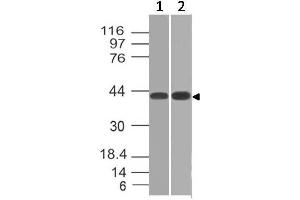 Image no. 1 for anti-Cytokine Receptor-Like Factor 2 (CRLF2) (AA 97-252) antibody (ABIN5027607) (CRLF2 antibody  (AA 97-252))