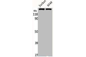 Western Blot analysis of Jurkat A549 cells using MRP7 Polyclonal Antibody (ABCC1 antibody  (Internal Region))
