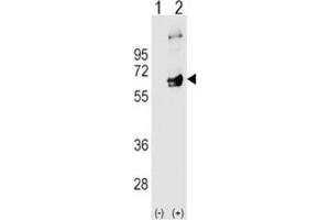 Western blot analysis of FYN antibody and 293 cell lysate (2 ug/lane) either nontransfected (Lane 1) or transiently transfected (2) with the FYN gene.