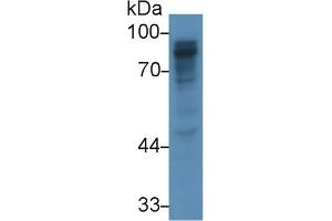 Detection of PIGR in Rat Liver lysate using Polyclonal Antibody to Polymeric Immunoglobulin Receptor (PIGR) (PIGR antibody  (AA 463-563))
