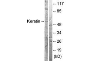 Western blot analysis of extracts from HeLa cells, treated with Anisomycin 25ug/ml 30', using Keratin 8 (Ab-73) Antibody.