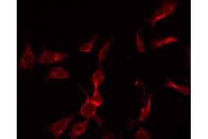ABIN6266936 staining K562 by IF/ICC. (DAK antibody  (Internal Region))