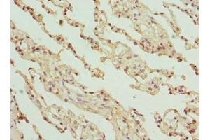 Immunohistochemistry of paraffin-embedded human lung tissue using ABIN7154146 at dilution of 1:100 (GLYCTK antibody  (AA 284-523))