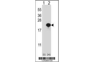 Western blot analysis of CYB5A using rabbit polyclonal CYB5A Antibody using 293 cell lysates (2 ug/lane) either nontransfected (Lane 1) or transiently transfected (Lane 2) with the CYB5A gene.