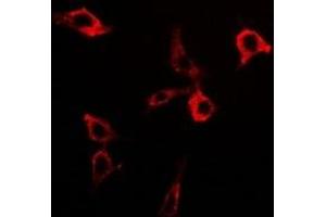 Immunofluorescent analysis of PDC-E2 staining in Hela cells. (DLAT antibody)