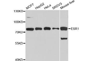 Western blot analysis of extracts of various cell lines, using ESR1 antibody (ABIN5970121) at 1/1000 dilution. (Estrogen Receptor alpha antibody)