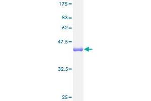 TNNC1 Protein (AA 1-161) (GST tag)