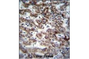 GCDH Antibody (C-term) (ABIN656829 and ABIN2846038) immunohistochemistry analysis in formalin fixed and paraffin embedded human liver tissue followed by peroxidase conjugation of the secondary antibody and DAB staining. (GCDH antibody  (C-Term))
