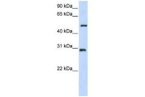 Western Blot showing ZNF138 antibody used at a concentration of 1-2 ug/ml to detect its target protein. (ZNF138 antibody  (N-Term))
