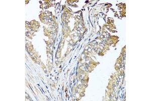 Immunohistochemistry of paraffin-embedded human prostate using STK3 antibody. (STK3 antibody  (AA 323-450))
