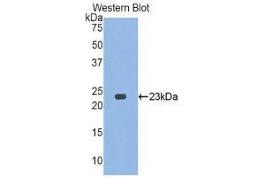 Western Blotting (WB) image for anti-Vanin 1 (VNN1) (AA 36-223) antibody (ABIN1175767) (VNN1 antibody  (AA 36-223))