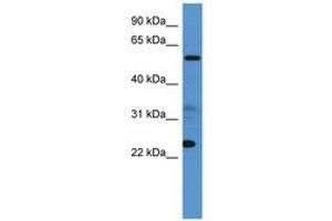 Image no. 1 for anti-Copine IX (CPNE9) (AA 359-408) antibody (ABIN6746107) (CPNE9 antibody  (AA 359-408))